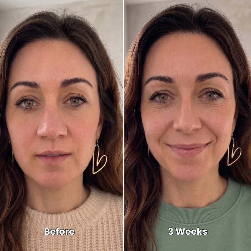 Ashley T. before and after 3 weeks of using the Mirvoso sculpting routine